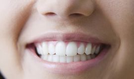 اكتشاف ارتباط بين فقدان الأسنان وزيادة خطر السمنة